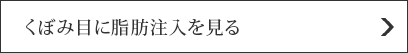 くぼみ目に脂肪注入を見る